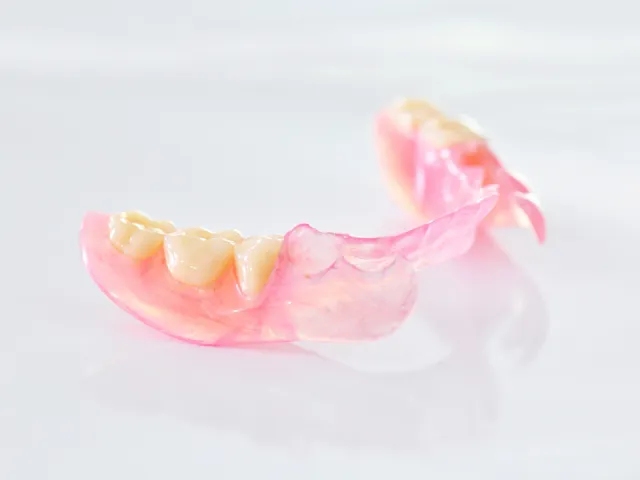 ノンクラスプデンチャー